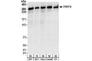 anti-PRP8 Pre-mRNA Processing Factor 8 (PRPF8) (AA 1825-1875) antibody