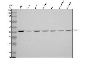 Western blot analysis of TMEFF1 using anti-TMEFF1 antibody (ABIN7825974).