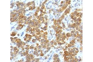 IHC testing of FFPE human parathyroid tumor with TL1A antibody (clone TLRM1-1). (TNFSF15 anticorps)