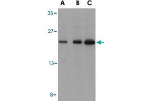 Western blot analysis of BAD in T24 cell lysates with BAD polyclonal antibody  at (A) 0. (BAD anticorps  (C-Term))