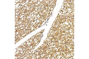Immunohistochemistry of paraffin-embedded rat brown adipose using UCP1 Rabbit pAb (ABIN6128899, ABIN6149883, ABIN6149885 and ABIN6221561) at dilution of 1:50 (40x lens).