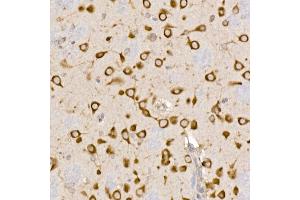 Immunohistochemistry of paraffin-embedded rat brain using Sterol carrier protein 2 Rabbit mAb (ABIN7270597) at dilution of 1:100 (40x lens).