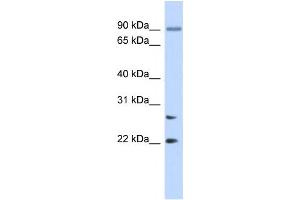 Western Blotting (WB) image for anti-Josephin Domain Containing 2 (JOSD2) antibody (ABIN2459544)