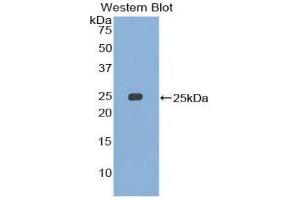 Western Blotting (WB) image for anti-Structural Maintenance of Chromosomes 3 (SMC3) (AA 994-1181) antibody (ABIN3207187) (SMC3 anticorps  (AA 994-1181))