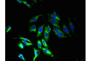 Immunofluorescent analysis of Hela cells using ABIN7173203 at dilution of 1:100 and Alexa Fluor 488-congugated AffiniPure Goat Anti-Rabbit IgG(H+L)