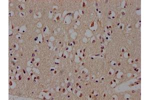 Immunohistochemistry of paraffin-embedded human brain tissue using ABIN7145172 at dilution of 1:300 (BCL11B anticorps  (AA 500-550))
