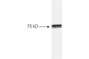 Image no. 1 for anti-Nuclear Factor-kB p65 (NFkBP65) (C-Term) antibody (ABIN221155) (NF-kB p65 anticorps  (C-Term))