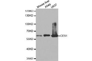 Western blot analysis of extracts of various cell lines, using CES1 antibody. (CES1 anticorps)
