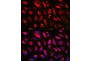 Immunofluorescence analysis of U2OS cells using TGF beta 1 antibody (ABIN7270909) at dilution of 1:150. (TGFB1 anticorps  (AA 30-278))