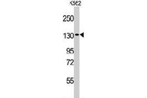Western blot analysis of VARS polyclonal antibody  in K-562 cell line lysates (35 ug/lane). (VARS anticorps  (N-Term))