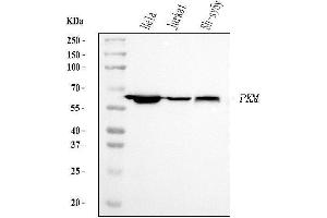 Western blot analysis of PKM2 using anti-PKM2 antibody (ABIN7603151).