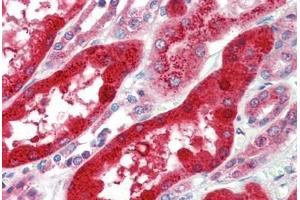 Human Kidney (formalin-fixed, paraffin-embedded) stained with SOX17 antibody ABIN462221 followed by biotinylated goat anti-rabbit IgG secondary antibody ABIN481713, alkaline phosphatase-streptavidin and chromogen.