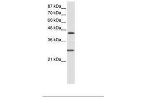 Image no. 2 for anti-Hairy and Enhancer of Split 6 (HES6) (C-Term) antibody (ABIN202083) (HES6 anticorps  (C-Term))