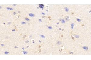 Detection of TNFa in Rabbit Cerebrum Tissue using Polyclonal Antibody to Tumor Necrosis Factor Alpha (TNFa) (TNF alpha anticorps  (AA 80-235) (APC))