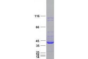 Validation with Western Blot