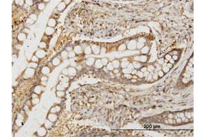 Immunoperoxidase of monoclonal antibody to NMI on formalin-fixed paraffin-embedded human small Intestine. (NMI anticorps  (AA 1-100))