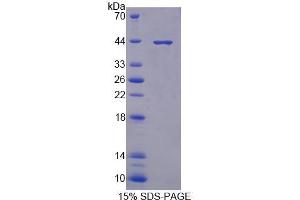 SDS-PAGE (SDS) image for Protein Kinase, X-Linked (PRKX) (AA 49-358) protein (His tag) (ABIN4990689)
