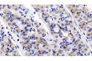 Detection of RPS6Kb1 in Porcine Stomach Tissue using Polyclonal Antibody to Ribosomal Protein S6 Kinase Beta 1 (RPS6Kb1)