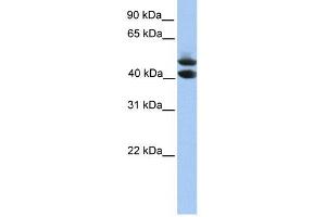 SOHLH1 antibody used at 1 ug/ml to detect target protein. (SOHLH1 anticorps  (C-Term))