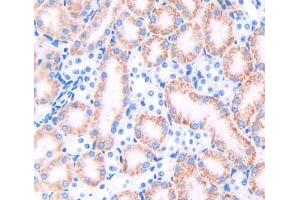 Used in DAB staining on fromalin fixed paraffin- embedded kidney tissue (TRAPPC10 anticorps  (AA 1077-1259))