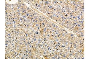 ABIN7094215 and ABIN7098261 at 1/100 staining mouse liver tissue by IHC-P.