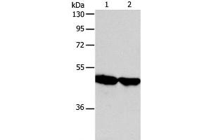 Western Blot analysis of Human fetal liver and liver cancer tissue using AADAC Polyclonal Antibody at dilution of 1:600 (AADAC anticorps)