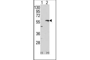 Image no. 1 for anti-Matrix Metallopeptidase 13 (Collagenase 3) (MMP13) (C-Term) antibody (ABIN358686) (MMP13 anticorps  (C-Term))