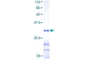 Image no. 1 for Ubiquitin Specific Peptidase 11 (USP11) (AA 201-300) protein (GST tag) (ABIN1324744)