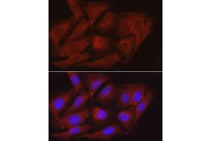 anti-Myosin Phosphatase, Target Subunit 1 (PPP1R12A) (AA 1-200) antibody