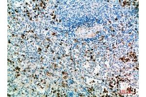Immunohistochemical analysis of paraffin-embedded human-spleen, antibody was diluted at 1:200