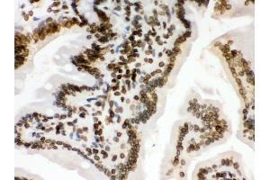 Anti- Lamin B1 Picoband antibody, IHC(P) IHC(P): Mouse Intestine Tissue