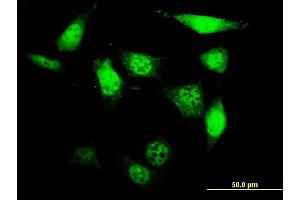 Immunofluorescence of monoclonal antibody to UCKL1 on NIH/3T3 cell. (UCKL1 anticorps  (AA 301-400))