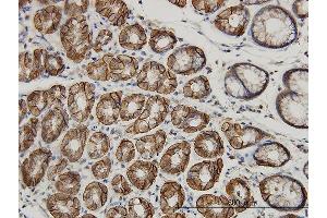 Immunoperoxidase of monoclonal antibody to AHCYL1 on formalin-fixed paraffin-embedded human stomach.