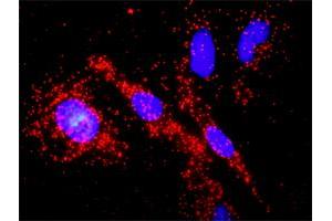 Proximity Ligation Analysis of protein-protein interactions between PTK2 and APC.