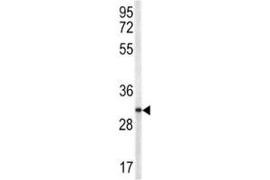 Western blot analysis of TRAP antibody and NCI-H460 lysate (CD40 Ligand anticorps  (AA 33-62))