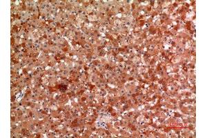 Immunohistochemistry (IHC) analysis of paraffin-embedded Human Liver, antibody was diluted at 1:100. (alpha 2 Macroglobulin anticorps  (Internal Region))