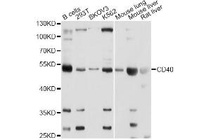 Western blot analysis of extracts of various cell lines, using CD40 Antibody. (CD40 anticorps)