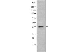 Western blot analysis NEUROD4 using COLO205 whole cell lysates (NEUROD4 anticorps  (N-Term))