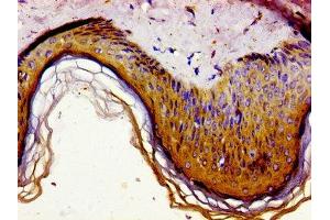 Immunohistochemistry of paraffin-embedded human skin tissue using ABIN7154478 at dilution of 1:100