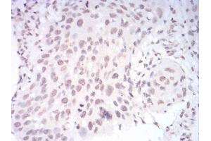 Immunohistochemistry (IHC) image for anti-Paired Box 6 (PAX6) (AA 1-122) antibody (ABIN5930091) (PAX6 anticorps  (AA 1-122))