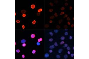 Immunofluorescence analysis of HeLa cells using Acetyl-Histone H2B-K5 antibody (ABIN7267733) at dilution of 1:100.
