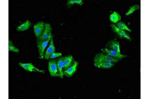 Immunofluorescent analysis of HepG2 cells using ABIN7144627 at dilution of 1:100 and Alexa Fluor 488-congugated AffiniPure Goat Anti-Rabbit IgG(H+L)