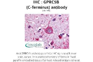 Image no. 1 for anti-G Protein-Coupled Receptor, Family C, Group 5, Member B (GPRC5B) (C-Term) antibody (ABIN1735212) (GPRC5B anticorps  (C-Term))