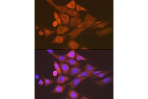 anti-S-Phase Kinase-Associated Protein 1 (SKP1) antibody