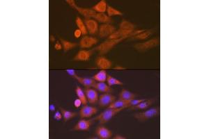 Immunofluorescence analysis of NIH-3T3 cells using SKP1 Rabbit mAb (ABIN7270120) at dilution of 1:100 (40x lens). (SKP1 anticorps)