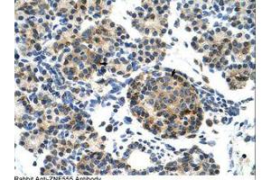 anti-Zinc Finger Protein 555 (ZNF555) (AA 128-177) antibody