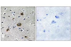 Immunohistochemistry analysis of paraffin-embedded human brain tissue using AKAP1 antibody. (AKAP1 anticorps  (Internal Region))