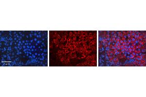 Rabbit Anti-HSPA1A Antibody   Formalin Fixed Paraffin Embedded Tissue: Human Liver Tissue Observed Staining: Cytoplasm Primary Antibody Concentration: 1:100 Other Working Concentrations: N/A Secondary Antibody: Donkey anti-Rabbit-Cy3 Secondary Antibody Concentration: 1:200 Magnification: 20X Exposure Time: 0.