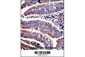 Mouse Prkd3 Antibody immunohistochemistry analysis in formalin fixed and paraffin embedded mouse duodenum tissue followed by peroxidase conjugation of the secondary antibody and DAB staining. (PRKD3 anticorps  (N-Term))