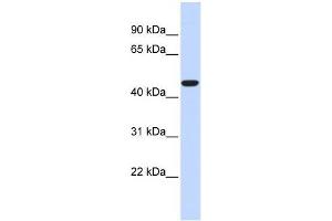 Human Heart; WB Suggested Anti-ACOT2 Antibody Titration: 0. (ACOT2 anticorps  (Middle Region))